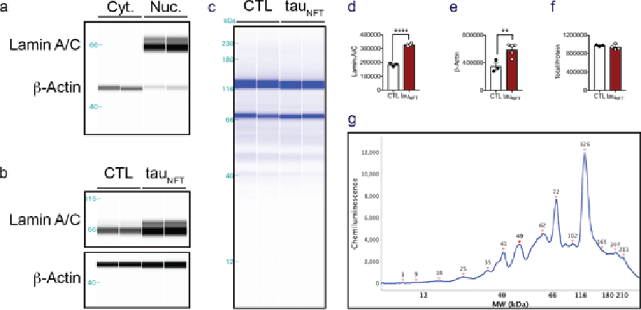  Using Total Protein Detection as an internal loading control when quantifying protein in tau transgenic mice.